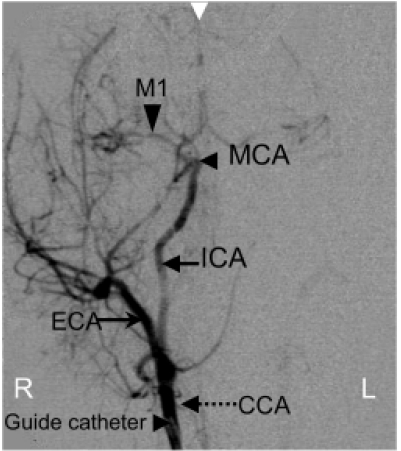 Imaging Stroke Evolution after Middle Cerebral Artery Occlusion in Non-human Primates.