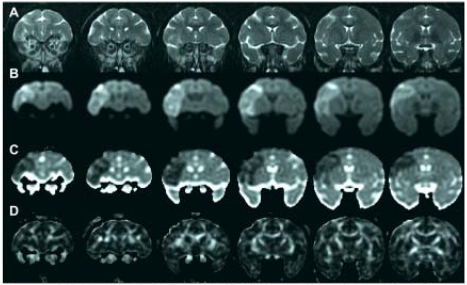 Imaging Stroke Evolution after Middle Cerebral Artery Occlusion in Non-human Primates.