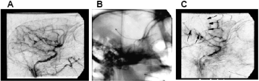 Imaging Stroke Evolution after Middle Cerebral Artery Occlusion in Non-human Primates.