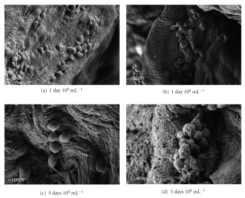 The pathogenesis of Candida infections in a human skin model: scanning electron microscope observations.