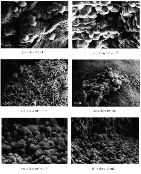 The pathogenesis of Candida infections in a human skin model: scanning electron microscope observations.