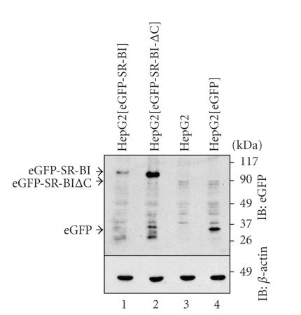 Modulators of Protein Kinase C Affect SR-BI-Dependent HDL Lipid Uptake in Transfected HepG2 Cells.