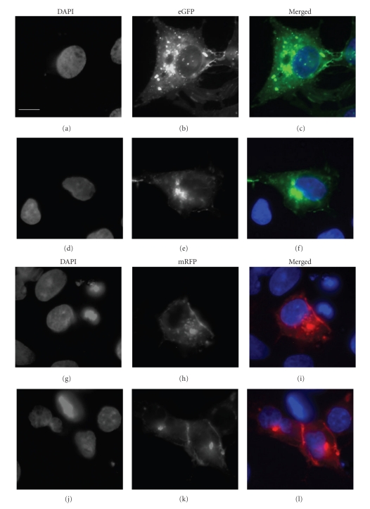 Modulators of Protein Kinase C Affect SR-BI-Dependent HDL Lipid Uptake in Transfected HepG2 Cells.