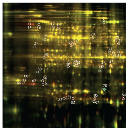 Proteomic Analysis of Soybean Roots under Aluminum Stress.