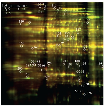 Proteomic Analysis of Soybean Roots under Aluminum Stress.