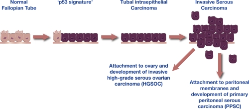 The new face of ovarian cancer modeling: better prospects for detection and treatment.