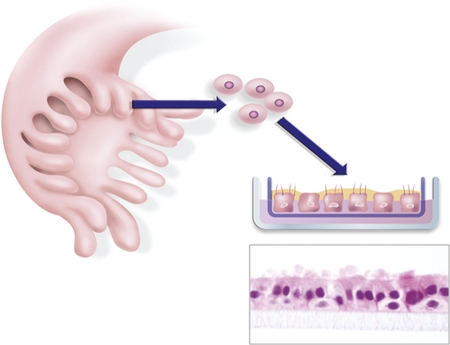 The new face of ovarian cancer modeling: better prospects for detection and treatment.