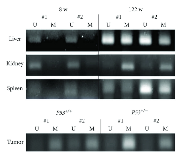 Establishment of Methylation-Specific PCR for the Mouse p53 Gene.