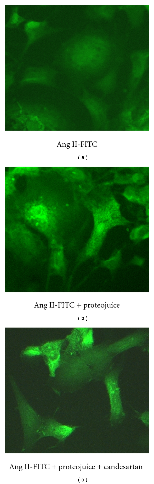 Jak2-Independent Activation of Stat3 by Intracellular Angiotensin II in Human Mesangial Cells.