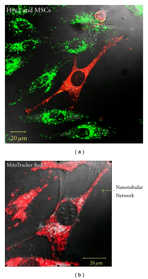 Bone marrow stem cell derived paracrine factors for regenerative medicine: current perspectives and therapeutic potential.