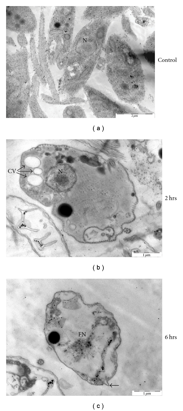 Cryptolepine-Induced Cell Death of Leishmania donovani Promastigotes Is Augmented by Inhibition of Autophagy.