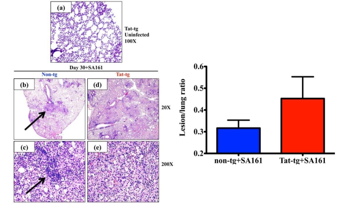 Immune Responses of HIV-1 Tat Transgenic Mice to Mycobacterium Tuberculosis W-Beijing SA161.