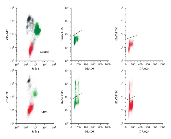 Innovative analyses support a role for DNA damage and an aberrant cell cycle in myelodysplastic syndrome pathogenesis.