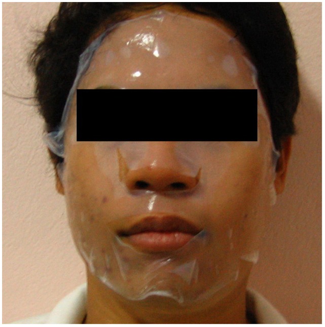 Effects of a cellulose mask synthesized by a bacterium on facial skin characteristics and user satisfaction.