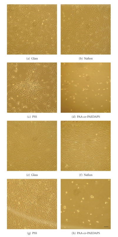 Human coronary artery smooth muscle cell responses to bioactive polyelectrolyte multilayer interfaces.