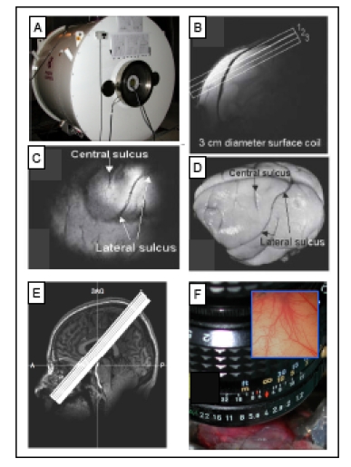 Methods for fine scale functional imaging of tactile motion in human and nonhuman primates.