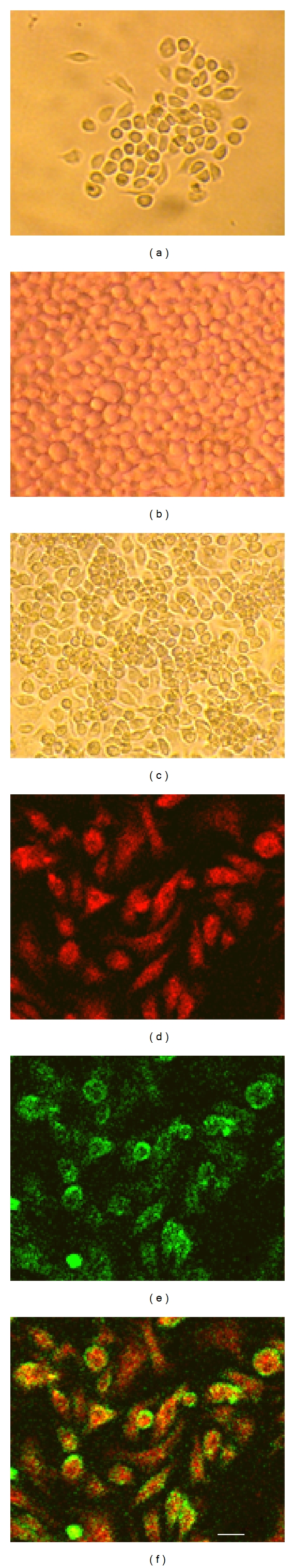 An in vitro study of differentiation of hematopoietic cells to endothelial cells.