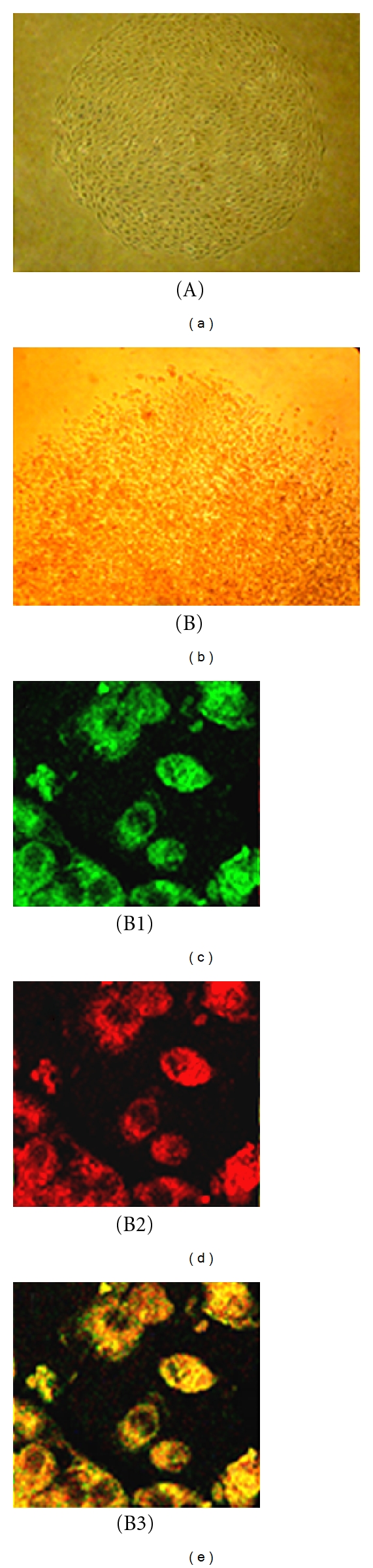 An in vitro study of differentiation of hematopoietic cells to endothelial cells.