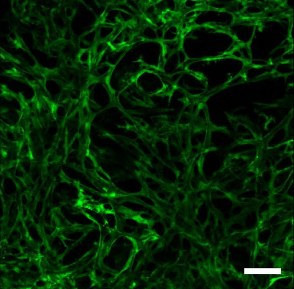 Application of microtechnologies for the vascularization of engineered tissues.