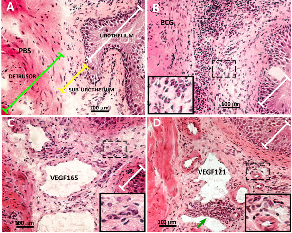 VEGF signaling mediates bladder neuroplasticity and inflammation in response to BCG.