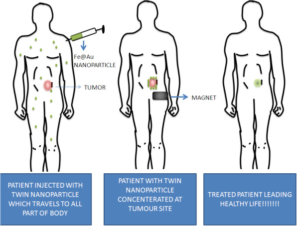 Nanoparticle mediated targeting of VEGFR and cancer stem cells for cancer therapy.