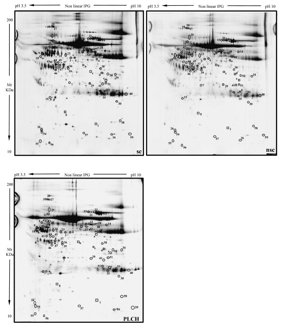 Proteome analysis of bronchoalveolar lavage in pulmonary langerhans cell histiocytosis.