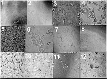 Vascular mimicry in cultured head and neck tumour cell lines.