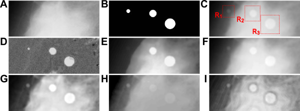 Mathematical morphology-based approach to the enhancement of morphological features in medical images.