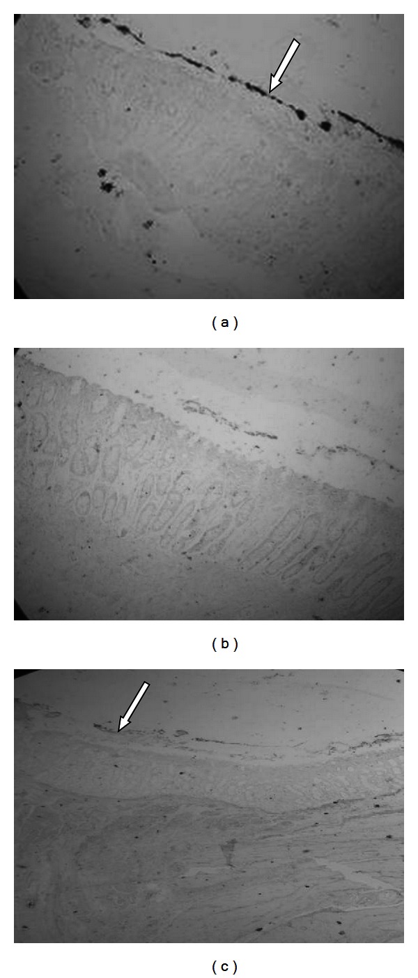 Reduction of Adherence of E. coli O157:H7 to HEp-2 Cells and to Bovine Large Intestinal Mucosal Explants by Colicinogenic E. coli.