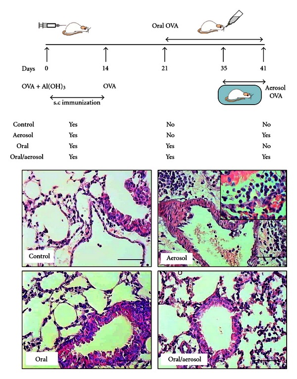 Prolonged antigen ingestion by sensitized mice ameliorates airway inflammation.