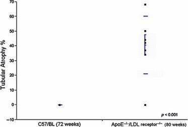 Mixed testicular atrophy related to atherosclerosis: first lessons from the ApoE−/−/ LDL receptor−/− double knockout mouse model