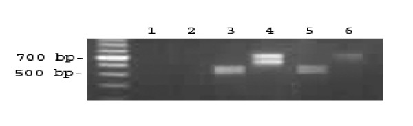 Radioimmunotherapy of experimental head and neck squamous cell carcinoma (HNSCC) with E6-specific antibody using a novel HPV-16 positive HNSCC cell line.