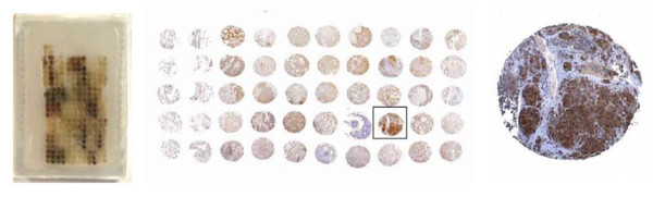 Proteomic characterization of non-small cell lung cancer in a comprehensive translational thoracic oncology database.