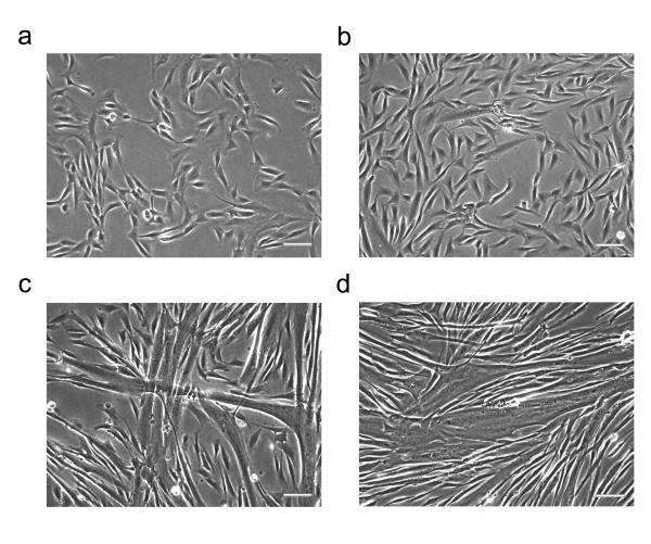 JAK/STAT signaling and human in vitro myogenesis.