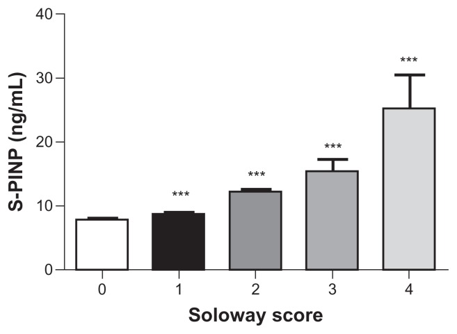 Serum N-Terminal Propeptide of Collagen Type I is Associated with the Number of Bone Metastases in Breast and Prostate Cancer and Correlates to Other Bone Related Markers.