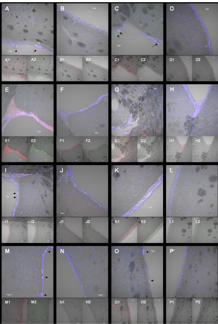 Age and sex differences in neural stem cell transplantation: a descriptive study in rats.