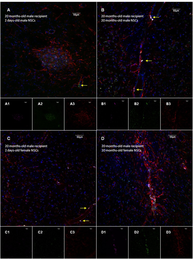 Age and sex differences in neural stem cell transplantation: a descriptive study in rats.