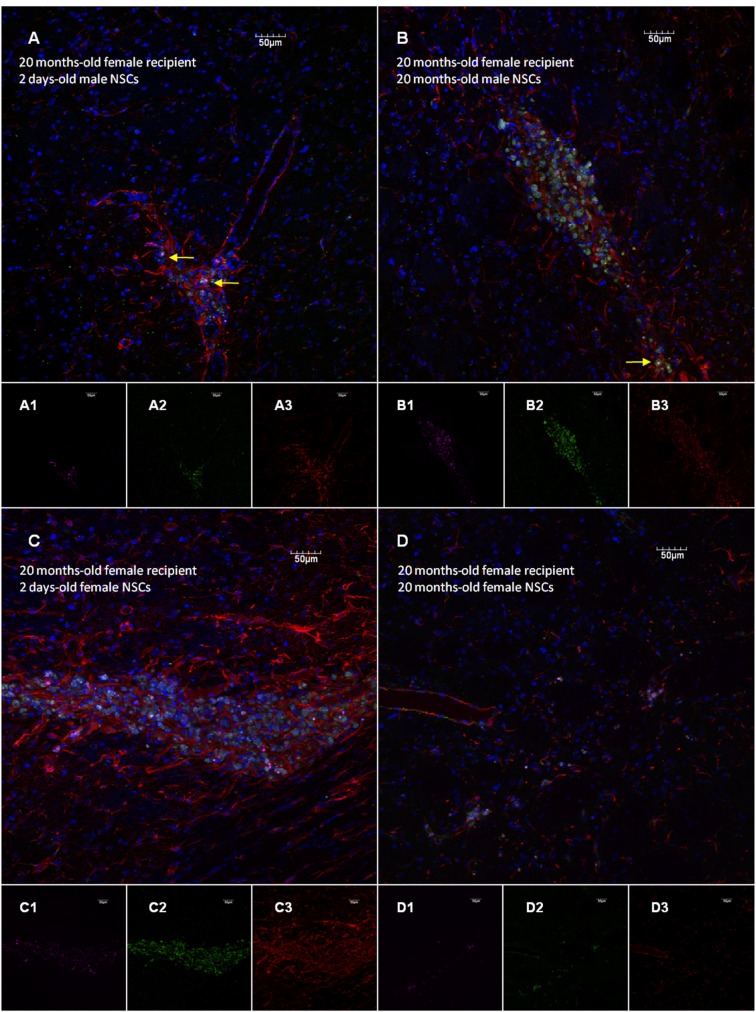 Age and sex differences in neural stem cell transplantation: a descriptive study in rats.