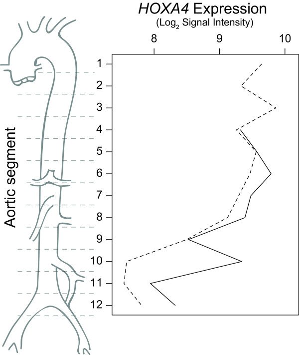 Regional expression of HOXA4 along the aorta and its potential role in human abdominal aortic aneurysms.