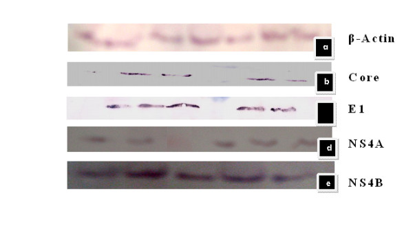 Establishment of stable Huh-7 cell lines expressing various hepatitis C virus genotype 3a protein: an in-vitro testing system for novel anti-HCV drugs.