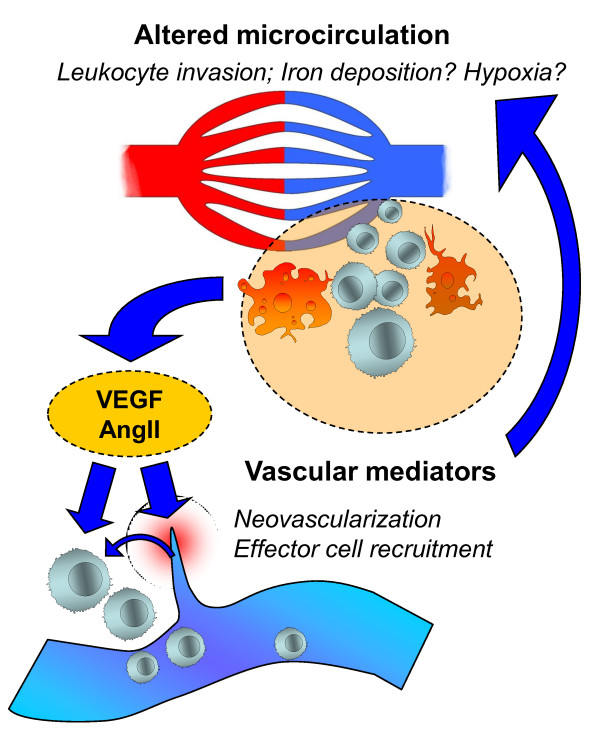 Vascular pathology in multiple sclerosis: mind boosting or myth busting?