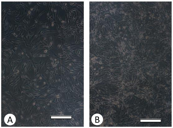 Characterization of chronic HCV infection-induced apoptosis.