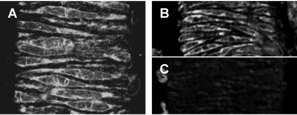 Calcium sparks in the intact gerbil spiral modiolar artery.