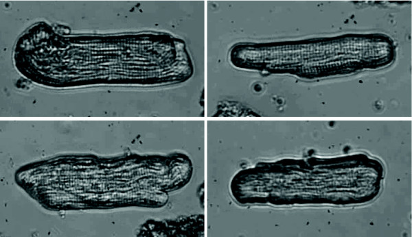 Introduction of non-linear elasticity models for characterization of shape and deformation statistics: application to contractility assessment of isolated adult cardiocytes.