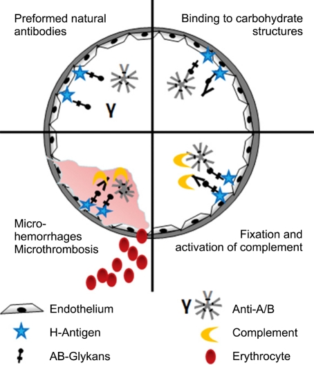 ABO-incompatible renal transplantation: From saline flushes to antigen-specific immunoadsorption-Tools to overcome the barrier.