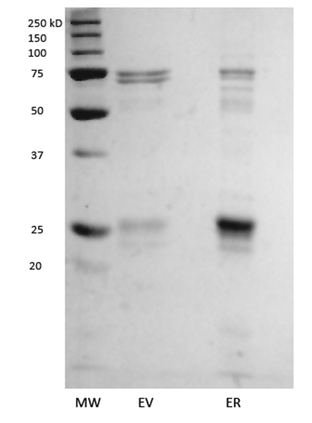 Use of differential scanning fluorimetry as a high-throughput assay to identify nuclear receptor ligands.