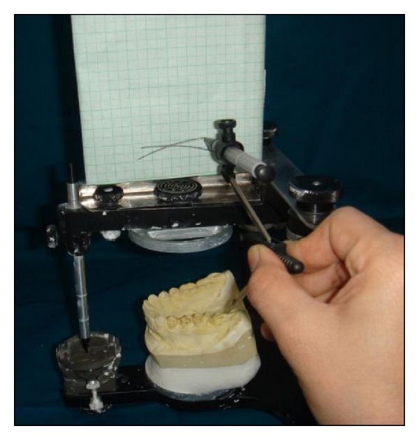 Occlusal plane determination using custom made broadrick occlusal plane analyser: a case control study.