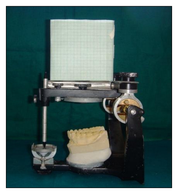 Occlusal plane determination using custom made broadrick occlusal plane analyser: a case control study.