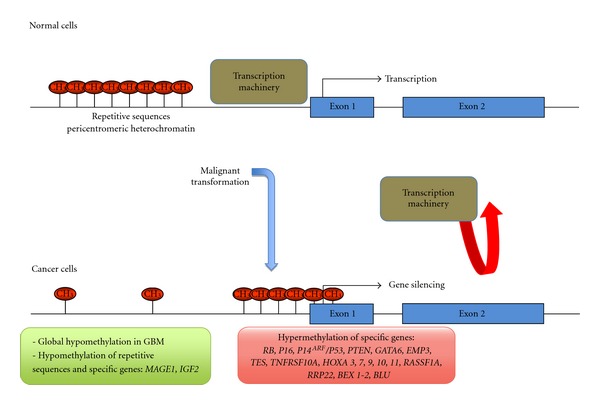 DNA methylation, histone modifications, and signal transduction pathways: a close relationship in malignant gliomas pathophysiology.