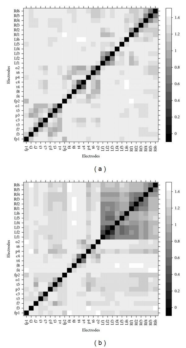 Extrahippocampal desynchronization in nonlesional temporal lobe epilepsy.